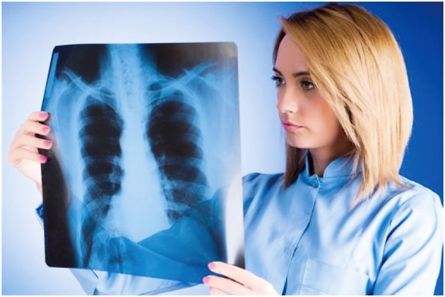  肺癌難發現 6個徵兆不可忽視 