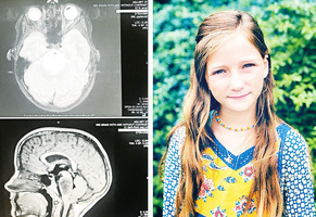 11歲女孩腦瘤奇蹟消失 父母：「是神治好了她」