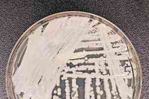 高致死率超級細菌現中國 最少18人感染