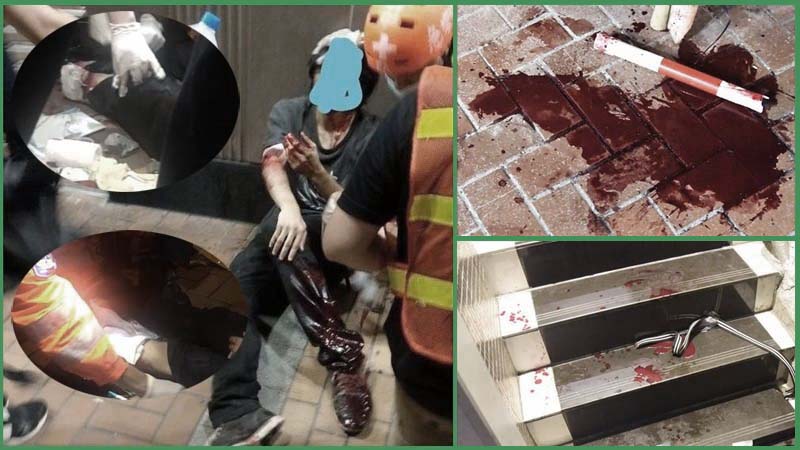 香港黑幫持刀砍傷示威者 血流滿地傷見骨
