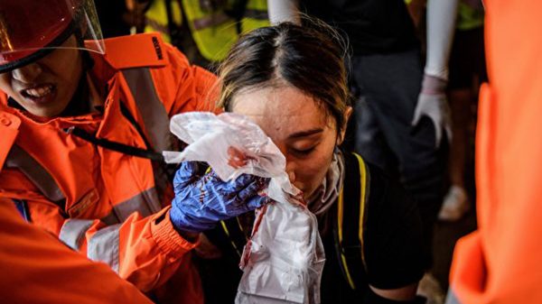 8月11日，警察在灣仔發射催淚彈，一女孩的右眼被射中。 （ANTHONY WALLACE/AFP/Getty Images）