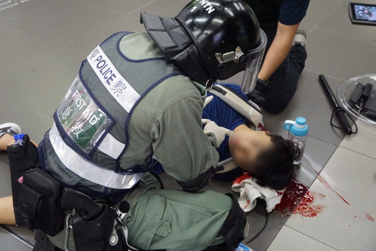 9月7日晚11時30分左右，港警在大埔站暴力圍毆一學生，學生頭被打破流出血漿。（網絡圖片）
