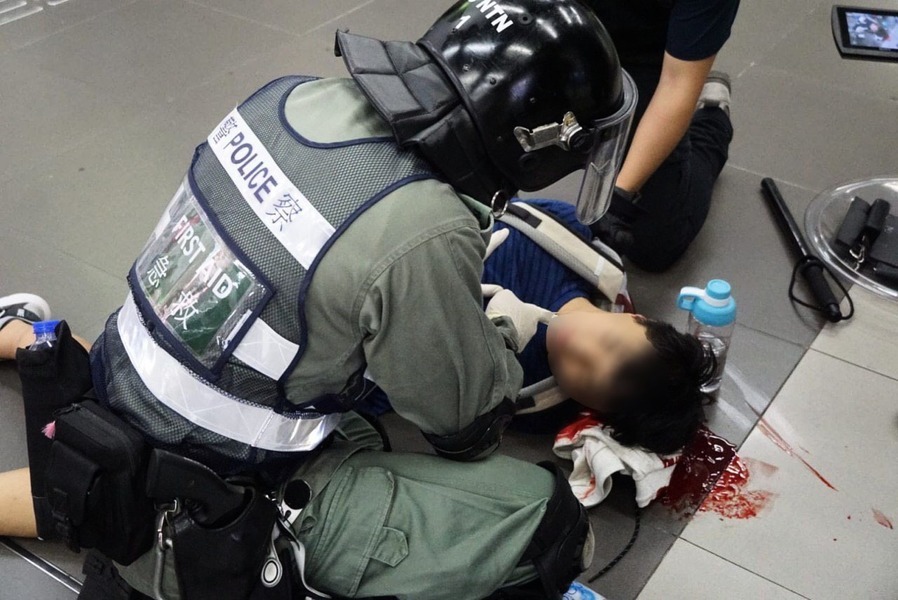 【9.7反送中】頭被打破淌出血漿 學生大埔墟站遭港警群毆