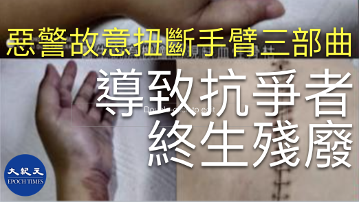 最近網上有片段顯示，香港警察在拘捕抗爭者後故意扭斷其手臂，使得其痛不欲生。（網路圖片）