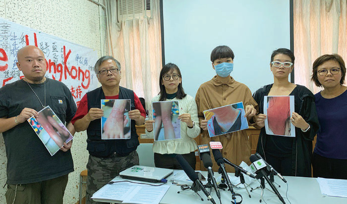  香港媽媽籲停止社區射催淚彈