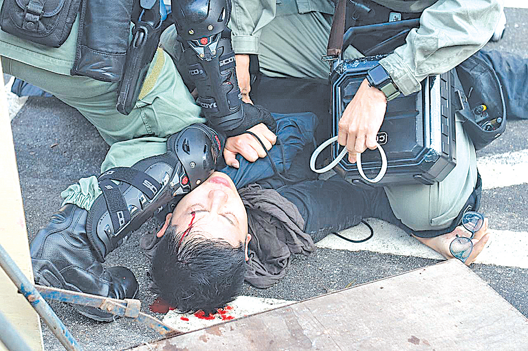 香港警隊原本被稱為「亞洲第一警隊」，如今已名聲掃地，被港人怒斥為「黑警」，警民之間出現嚴重裂痕。圖為11月12日，港人「三罷」行動，香港中大學生被港警打爆頭流血。（宋碧龍／大紀元）
