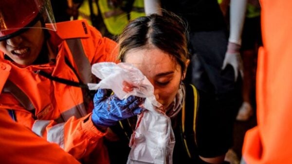 8月11日，有女急救員疑似被警方發射的布袋彈射中右眼，血流不止，恐將失明。 （ANTHONY WALLACE/AFP/Getty Images）