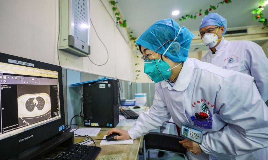圖為2020年1月30日中國湖北省武漢市一家醫院的醫務人員查看中共肺炎（俗稱武漢肺炎、新冠肺炎）患者的肺部CT圖像。（STR/AFP via Getty Images）