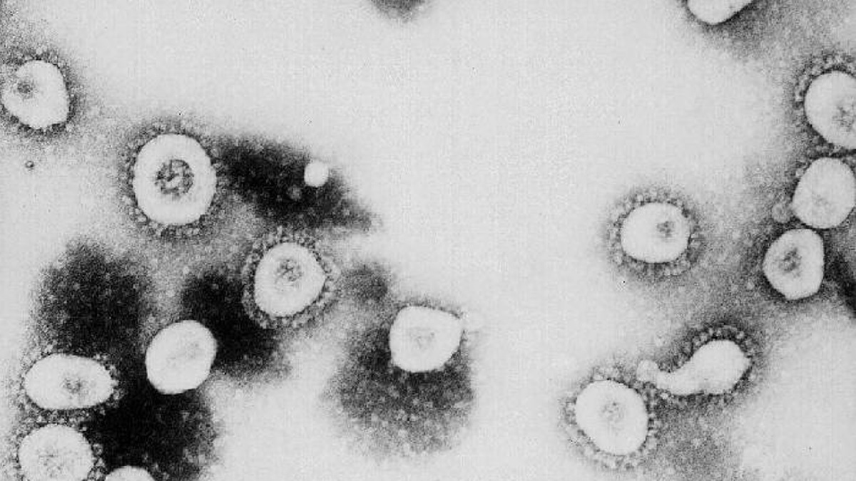 來自美國疾病控制與預防中心（CDC）的講義照片，展示了中共病毒的顯微圖。（CDC/Getty Images）