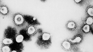 世衛專家：中共病毒是首種符合「X病」標準的病毒