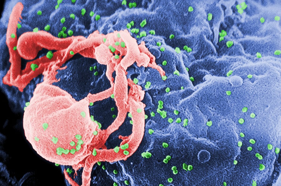  英男子成為第二名愛滋病治癒患者