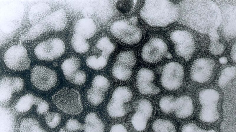 流感病毒示意圖。（維基百科）