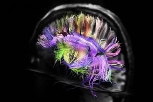 最新研究：大腦活動之複雜令人無法想像