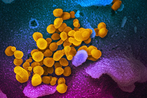 圖為掃描透射電子顯微鏡下的中共病毒（黃色，SARS-CoV-2）。藍色和紫色是皮膚。圖片由美國國家過敏和傳染病研究所（National Institute of Allergy and Infectious Diseases）2020年2月11日發布，樣品來自美國一個感染了中共病毒的病人。（美國國家過敏和傳染病研究所）