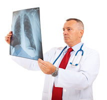 肺癌居癌症死亡首位初期無明顯症狀 重度吸菸者應每年定期篩檢