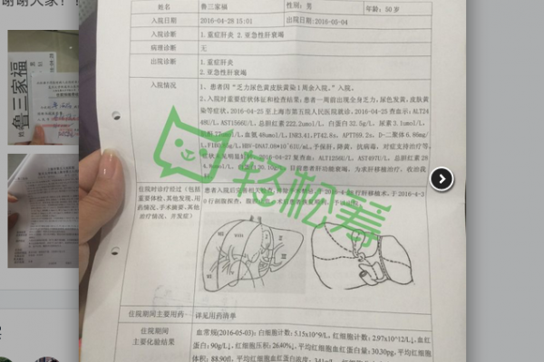 網曝「肝衰竭」患者上海華山醫院當天肝移植