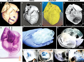 外科醫生的新工具：三維打印心臟誕生
