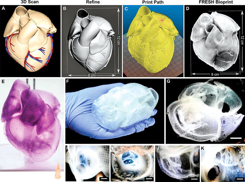 外科醫生的新工具：三維打印心臟誕生