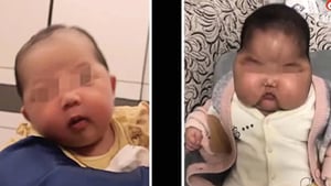 中國又現大頭娃娃 嬰兒霜含超強激素