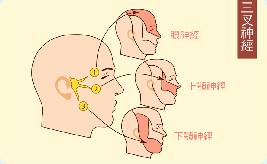 牙痛久治不癒 元兇竟是三叉神經痛