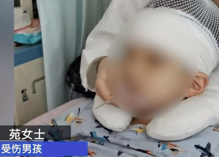 【前線採訪】9歲男童被體罰致頭皮頭骨分離引眾怒