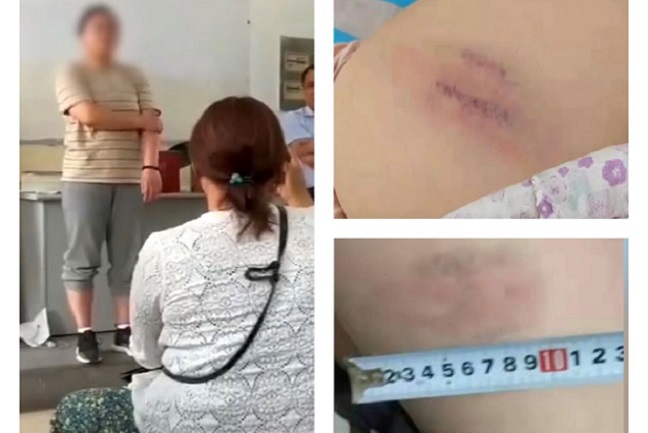 山東棗莊市紅旗小學一體育老師毆打全班54名學生，有學生被毆打至骨盆碎裂。（視頻截圖）