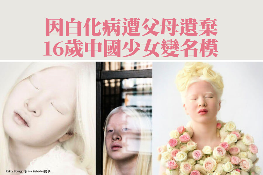 因白化病遭父母遺棄 16歲中國少女變名模【影片】