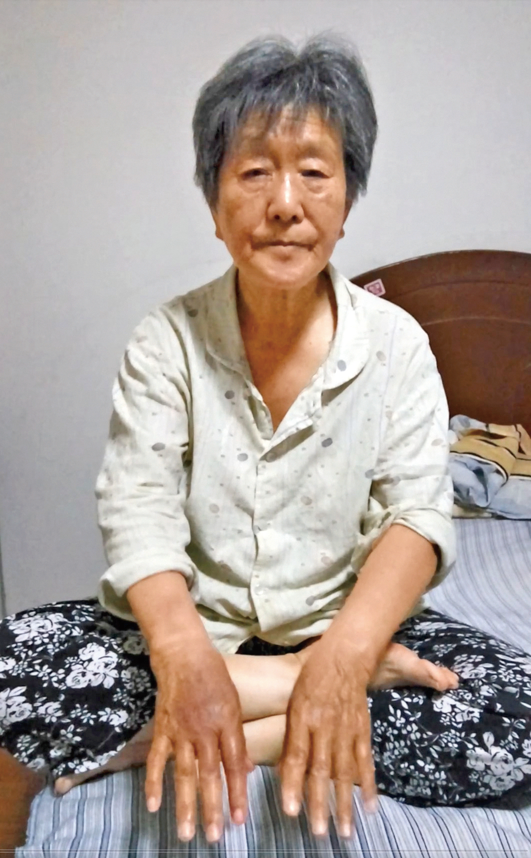 75歲的法輪功學員姜廣鳳被天津警察打嘴巴子，強制在誣蔑法輪功的所謂「三書」上按手印。  ,姜廣鳳的右手食指、中指、無名指，均 被警察掰得通紅、發黑和腫脹。（明慧網）