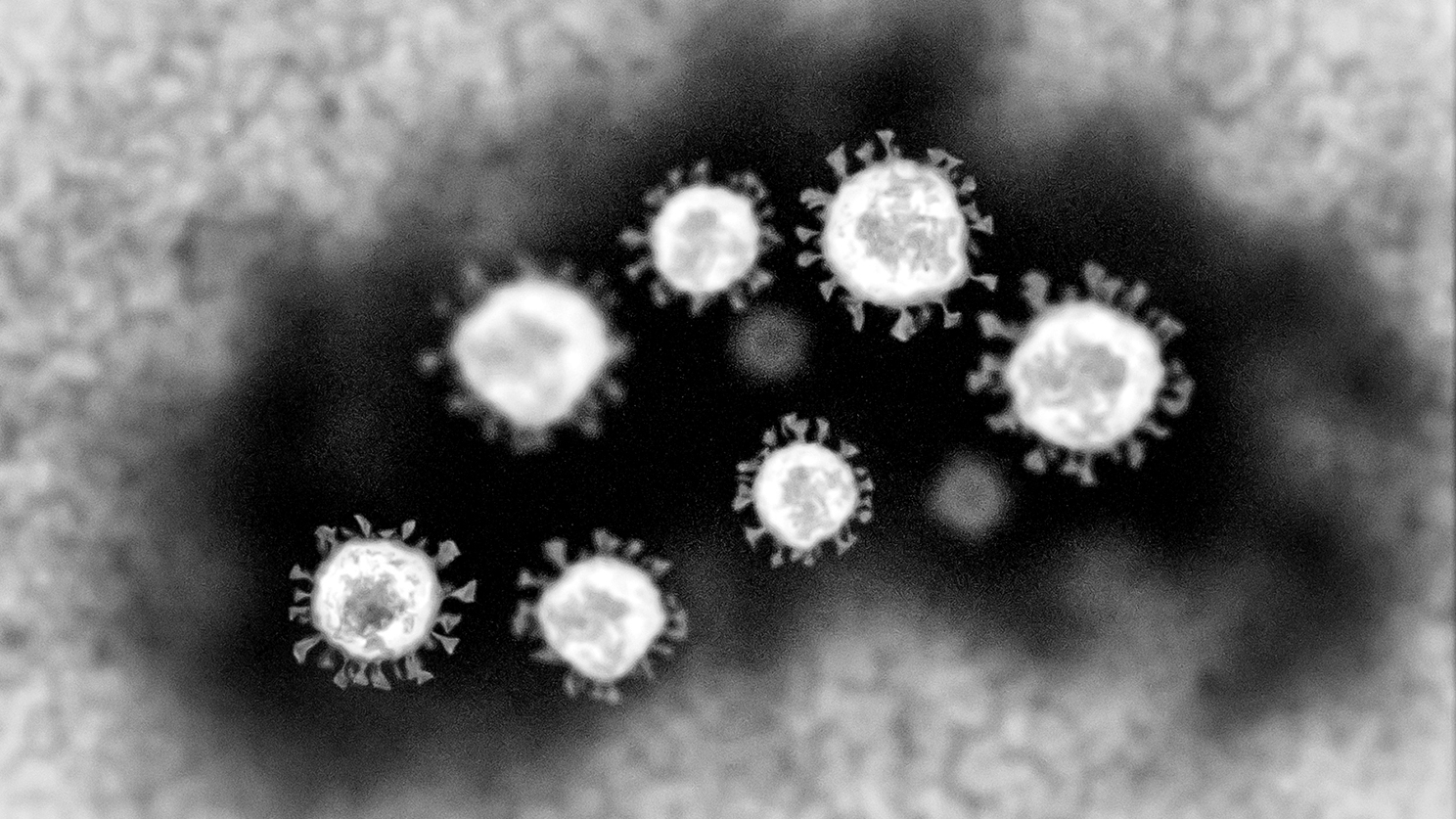 電子顯微鏡下看到的冠狀病毒。（Shutter Stock）
