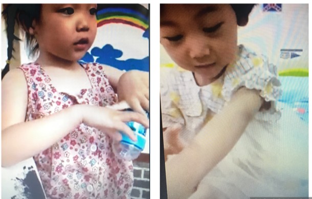 紅黃藍虐童案重演 黑龍江一幼兒園老師用針扎孩子
