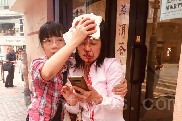 2019年9月24日，法輪功學員廖女士在長沙灣警署與警方開會商議10.1遊行離開後遭到遇襲，頭部受傷流血。（安帕／大紀元）