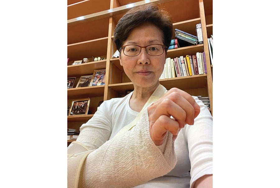 行政長官林鄭月娥前晚在禮賓府跌倒，右手手肘輕微骨折。（林鄭月娥Facebook圖片）