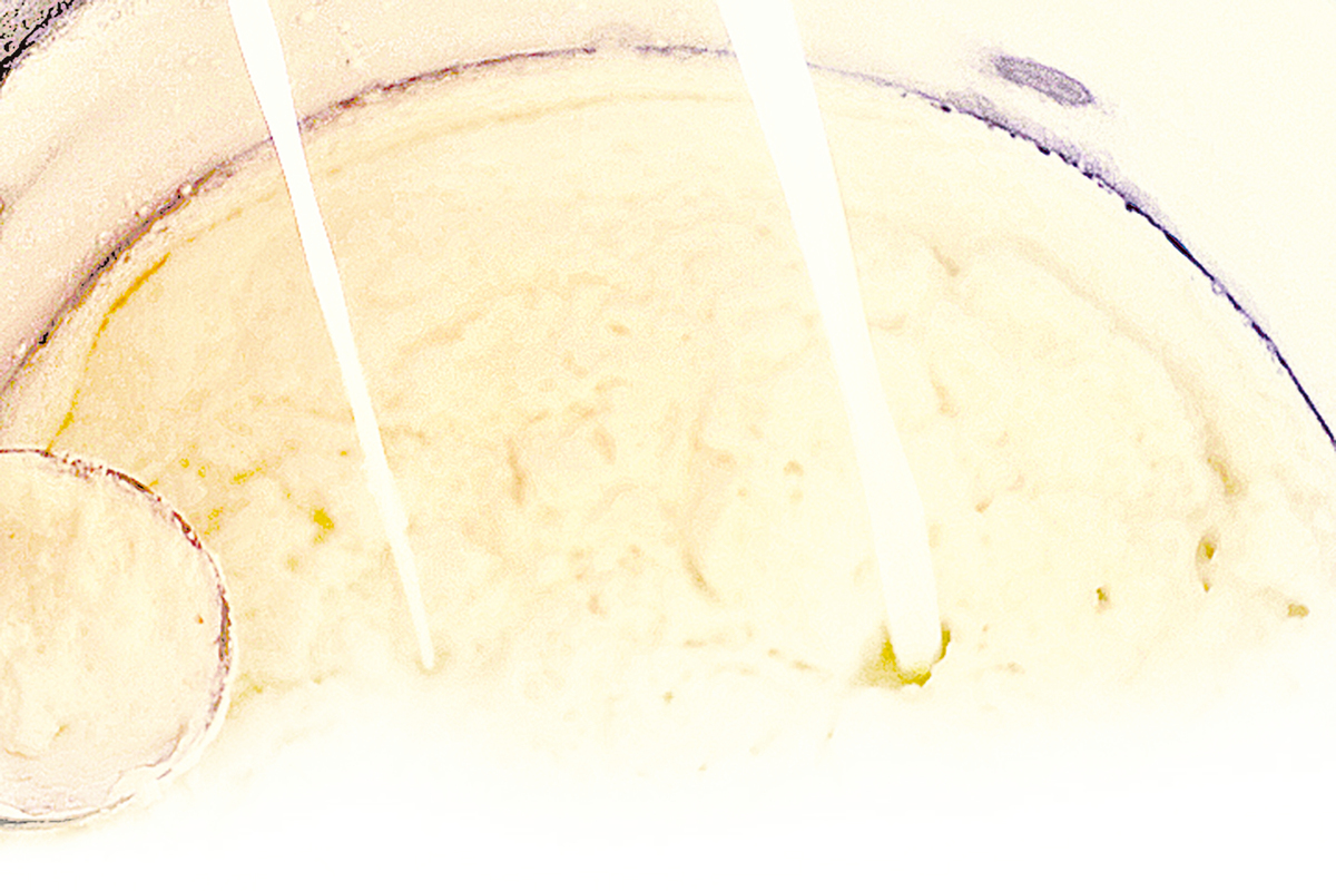 不同文化中都發展出自己的發酵奶，圖為土耳其傳統鹹乳酪。（圖／Fotolia、shutterstock）