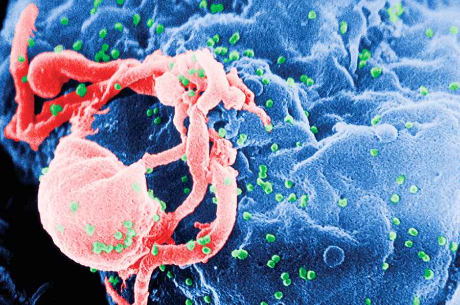 愛滋病毒出現新變種致病速度翻倍