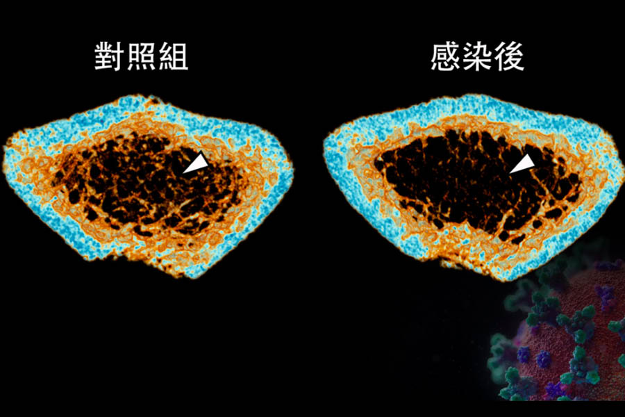 三維微米級計算機斷層成像技術重建顯示，感染中共病毒的倉鼠（圖右）在股骨的小梁骨（白色箭頭）密度明顯低於未感染的對照組（圖左）。（港大醫學院網站）