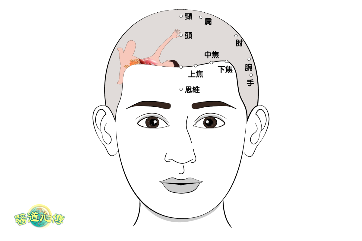 頭皮針-方雲鵬-頭部前面部位示意圖。（醫道心傳製作組製圖）