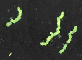 科學家發現2公分長細菌 顛覆人類認知