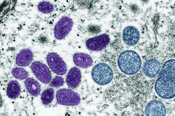 美國CDC提供的2003年電子顯 微鏡圖像顯示了成熟的猴痘病毒粒 子（左側）和球形未成熟病毒粒子 █ 泰國總理巴育。（AFP） （右側）。（/CDC）