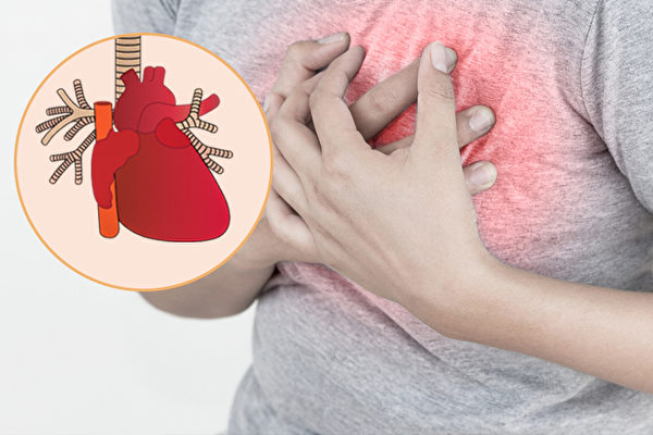 糖尿病易導致心血管病變，專家建議定期做篩查，以預防心血管併發症。（Shutterstock/大紀元製圖）