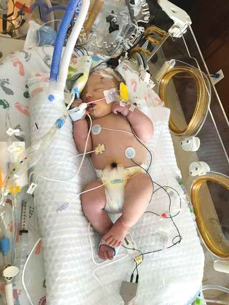 新生兒停止呼吸 20分鐘後奇蹟復活 醫生不解