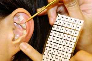 研究：中國傳統耳穴療法對婦科疾病有療效