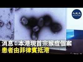 消息：本港現首宗猴痘個案 患者由菲律賓抵港 