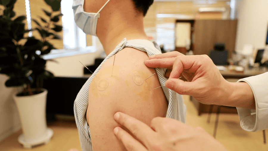 臨床研究：韓醫療法對退行性肩關節炎有效