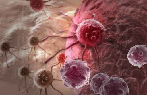 研究：中藥可為治療膠質母細胞瘤提供新的途徑