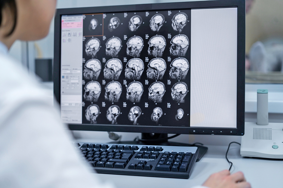 大腦磁力共振（MRI）成像技術為科學家研究大腦內部運作機制提供了一個很好的方法。圖為大腦MRI圖像。(Freepik)