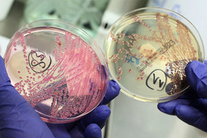 世衛公佈最致命十二種細菌 警告即將無藥可醫