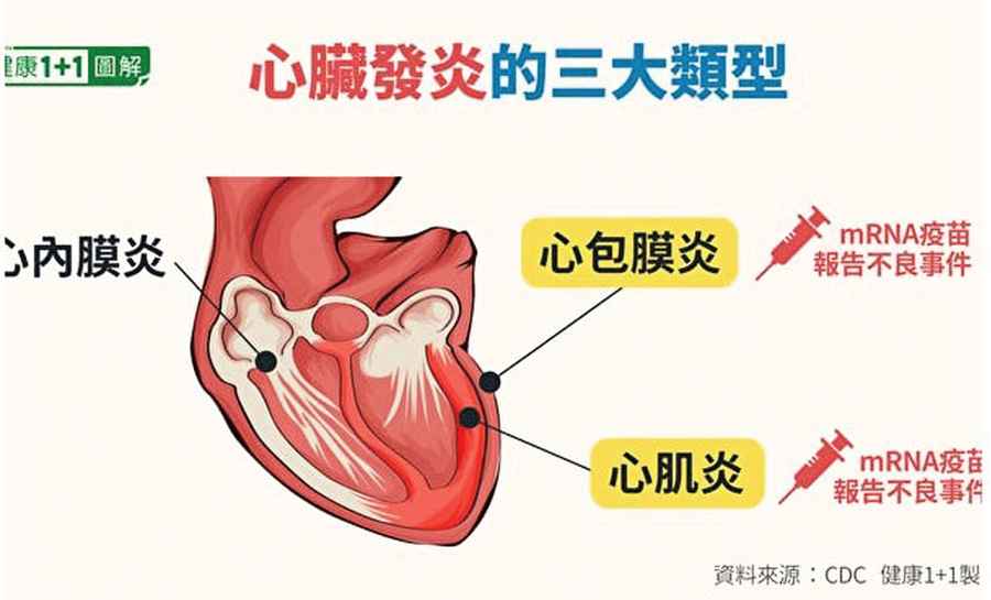 疫苗副作用再引質疑 中國一女孩倒地心臟停跳