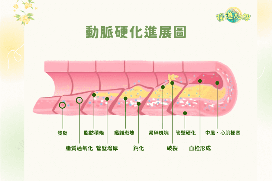 【醫道心傳】7種食物清血管 預防心肌梗塞和中風