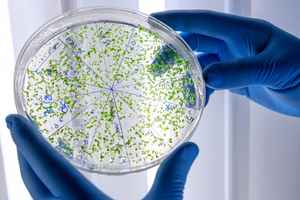 新型聚合物為戰勝耐藥性細菌帶來希望