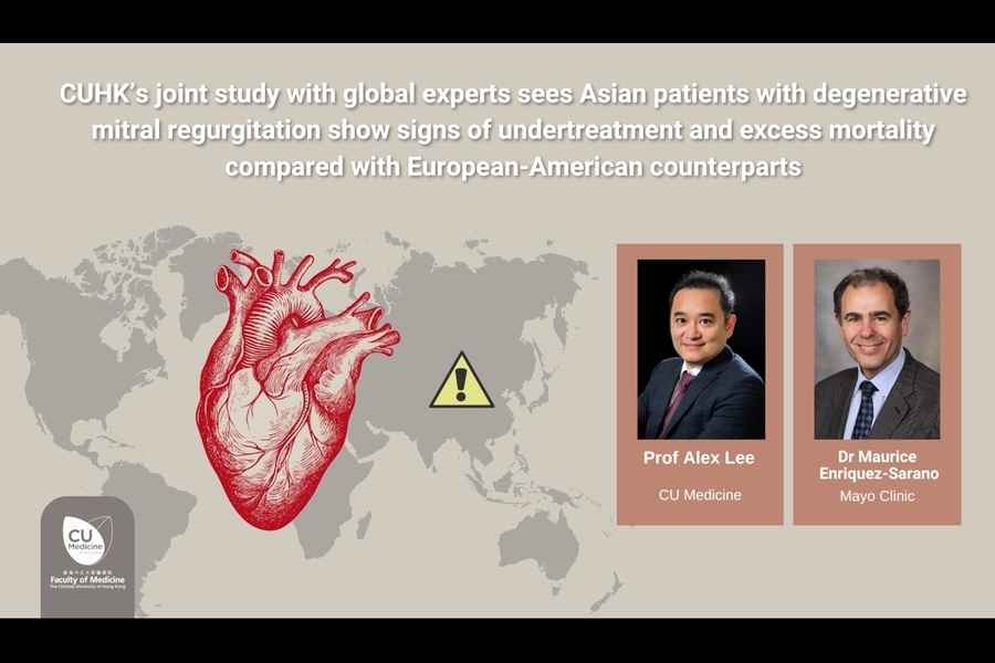 研究：「二尖瓣倒流」亞洲患者死亡率較預期高